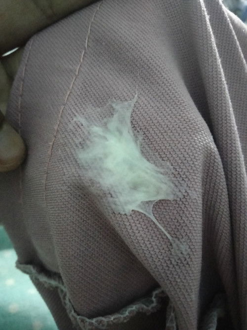 34+2แบบนี้คือใกล้คลอดยังค่ะ