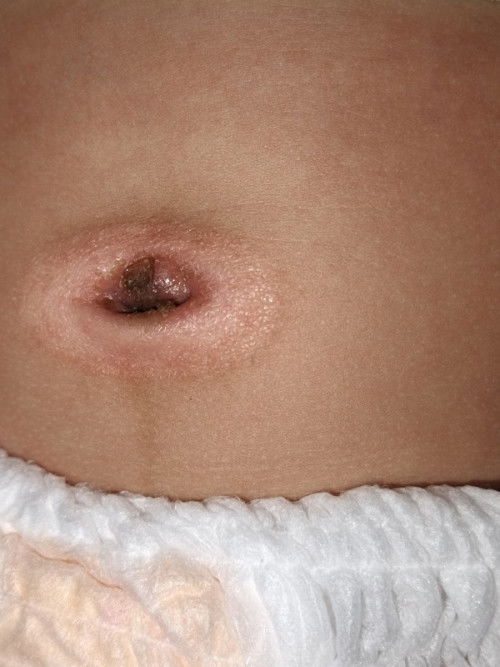 Pusat bayi usia 2 bulan