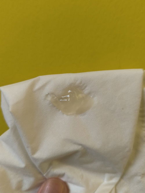 Usia kehamilah 39 minggu mulai keluar seperti lendir cukup banyak