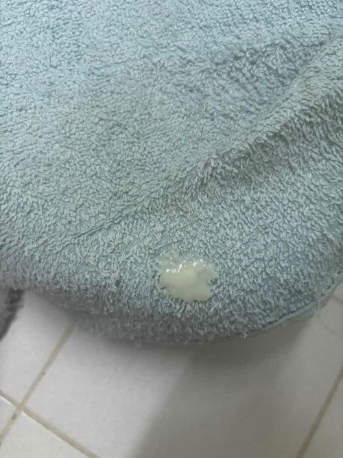 แบบนี้ไหลออกมาคืออะไรคะ อันตรายไหม