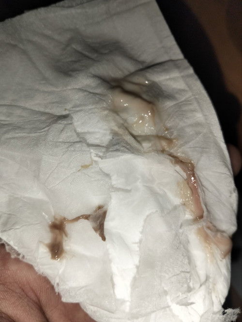 Kecoklatan di usia kandungan 32 Minggu