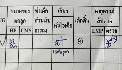 สอบถามแม่ๆค่ะ