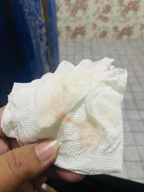 38+1 มูกเลือดไหมค่ะ