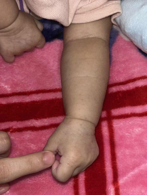 รอยแบบนี้เกิดจากอะไรได้บ้างคะ