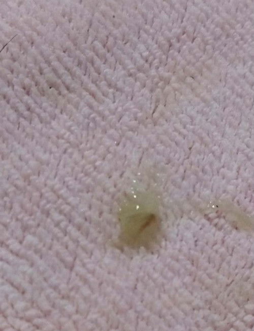 mucus plug n po ba to ? konti lang po to