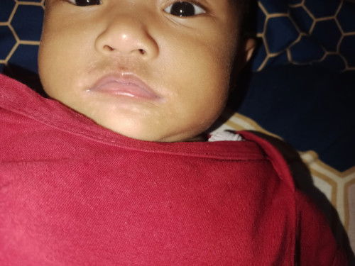 Itu knp ya Bun dulu cuma 1 d dagu ini kok banyak