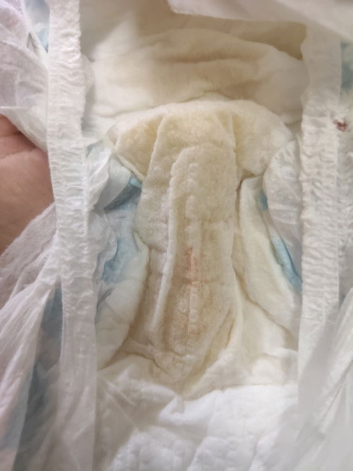 KENCING BAYI 2 BULAN