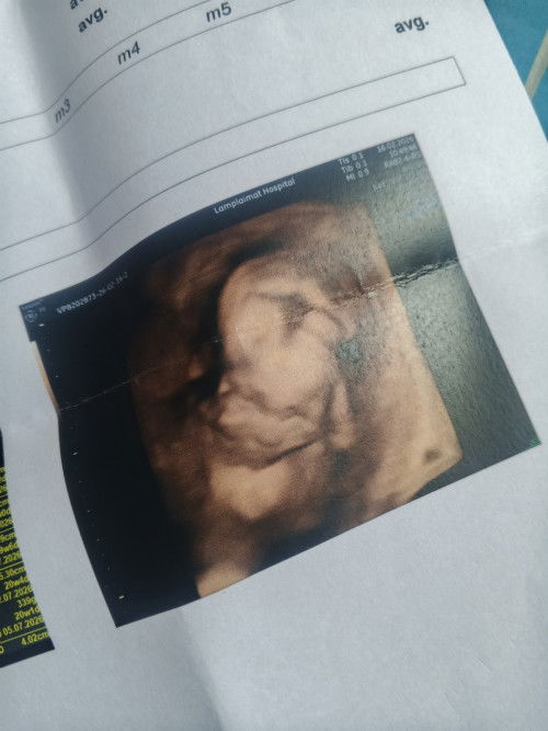 แม่ๆบเานไหนทีมกรกฎาคมบางค่ะ