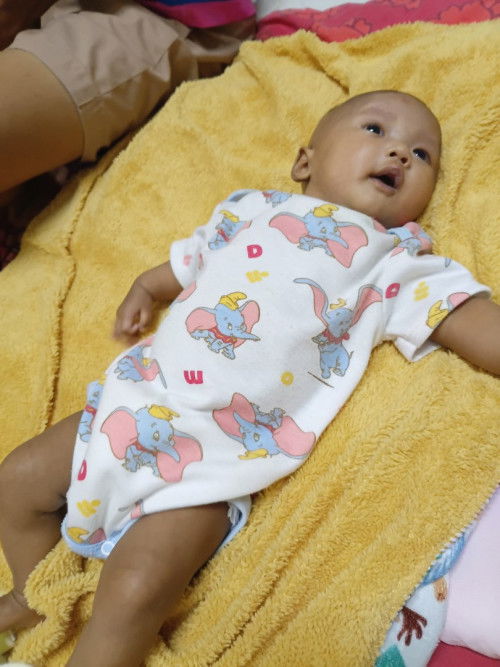 น้องคลอดก่อนกำหนดค่ะ คลอดตอน36+3  อายุน้อง2เดือน26วัน (อายุปรับ1เดือนครึ่ง)