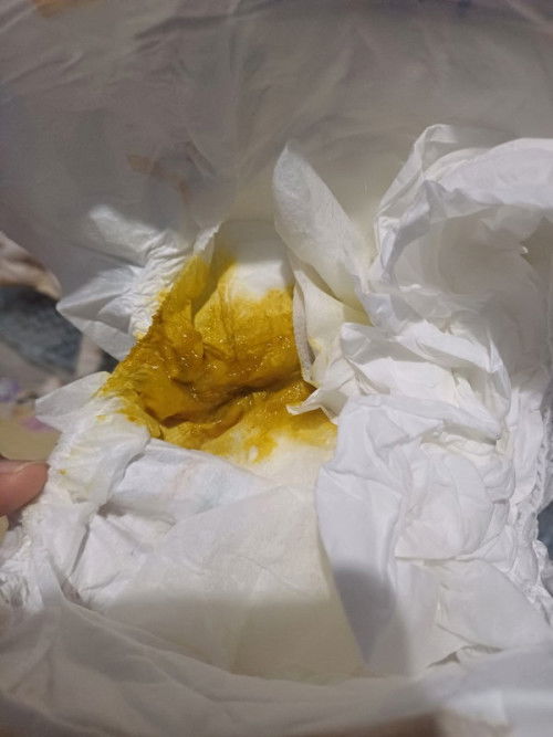 Apakah anak saya diare