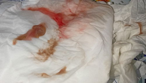 38 minggu 3 hari keluar lendir sama darah