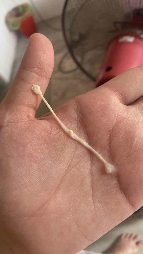 lendir keputihan 37 minggu 