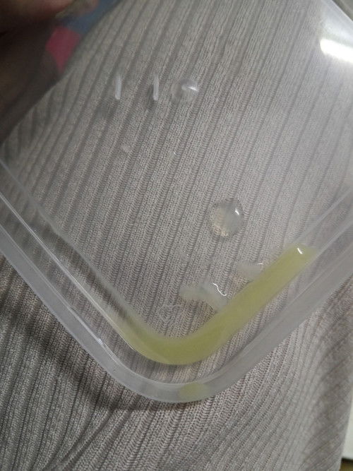 Cecair hijau melekit