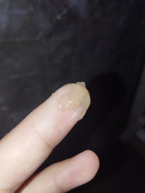 Keluar lendir tapi pas dipegang ga ancur