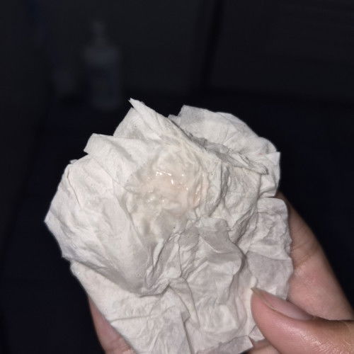 ตั้งครรภ์ได้ 24 week