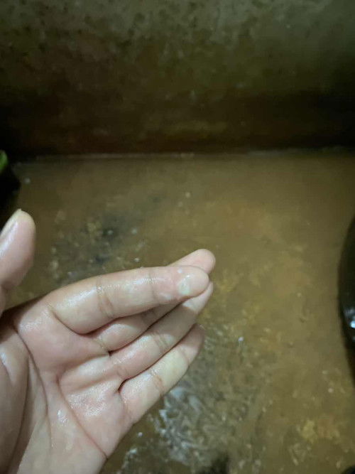 มีมูกออกมาแบบบนี้อันตรายมั้ย