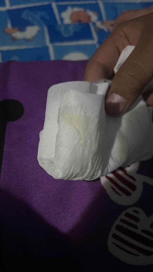 แบบนี้คือมูกใช่ไหมค่ะ