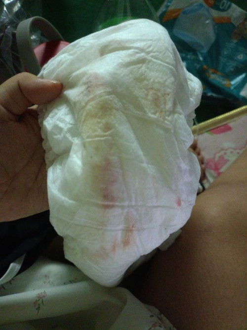 33+6วีค มีเลือดออก