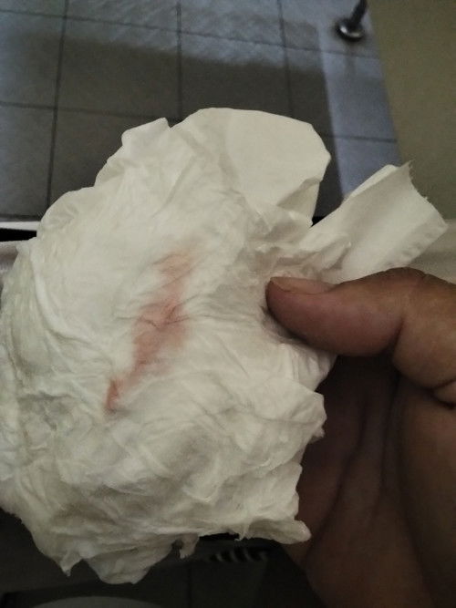 ท้องแรกค่ะ 31วีค