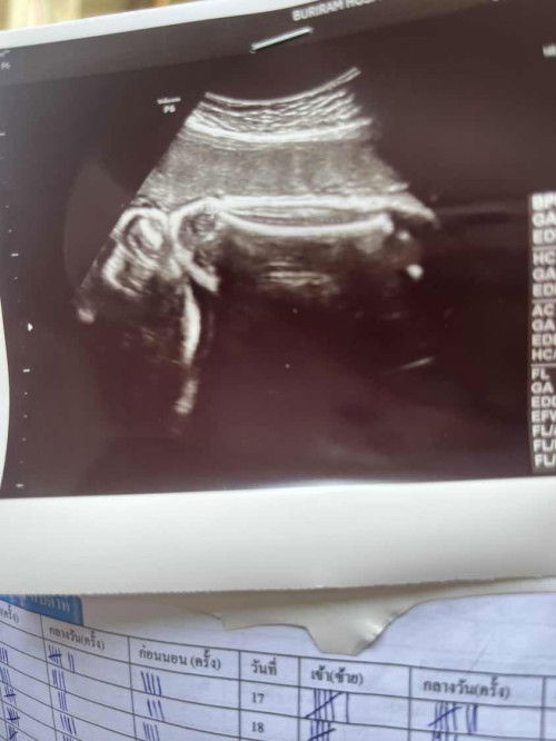 แม่ๆบ้านไหนดูออกบ้างคะ