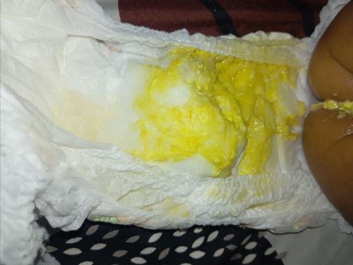 Pup/ bab bayi 8 bulan