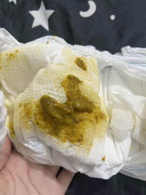 อุจาระทารกวัย7เดือนกว่าเป็นแบบนี้ปกติมั้ยคะ