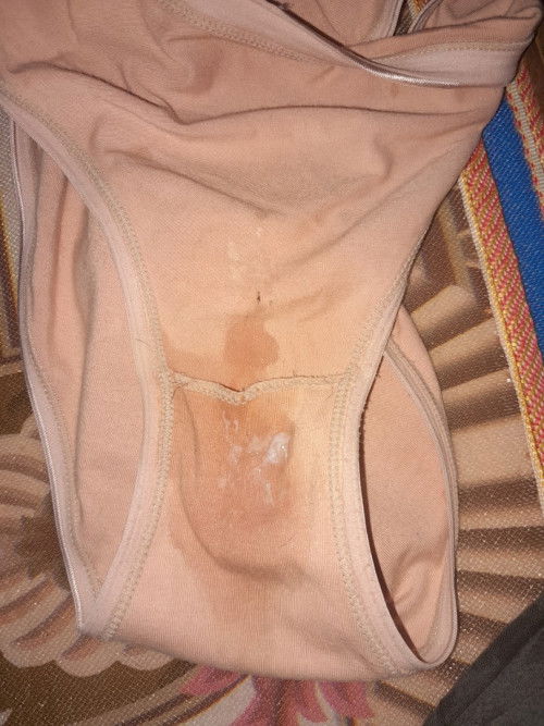 Normal lang po ba ito sa 22weeks?