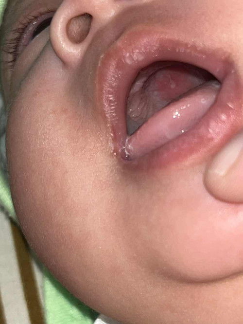 ช่วยอ่านตอบคำถามให้หายกังวลที