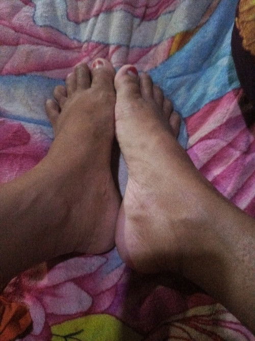 2 hari ini kaki udah mulai bengkak