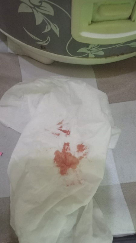 Ini kira2 kenapa ya bund ..