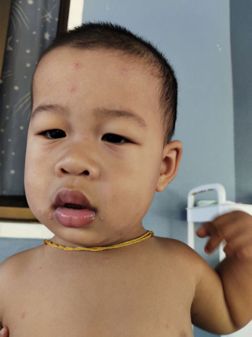 มีลูกใครเป็นแบบนี้มั้ยคะ