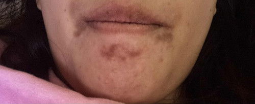 ใช้อะไรดีคะแนะนำหน่อยค่ะ