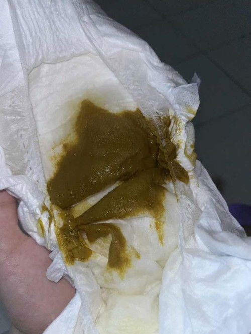 Anak minum susu formula