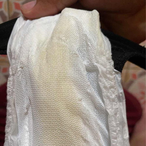 ขอสอบถามแม่ๆหน่อยค่ะ36+4ตอนแรกรู้สึกเหมือนมีน้ำไหลออกมาเรื่อยๆเลยตอนแรกคิดว่าน้ำคร่ำเลยลองใส่ผ้าอนามัยดูไม่มีแสบไม่มีคันปกติมั้ยค่ะ