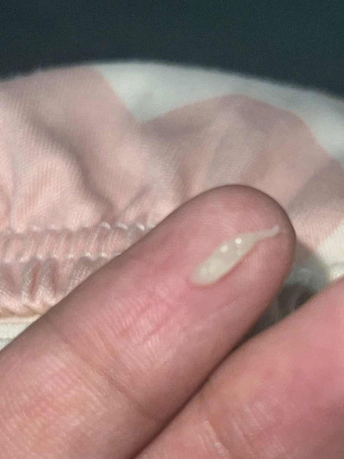 Normal lang po ba may ganitong discharge?8weeks pregnant po please reply po nagwoworry po ako