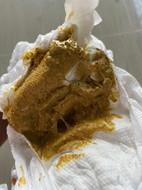 3เดือน10วัน ถ่ายแบบนี้ปกติมั้ยคะ