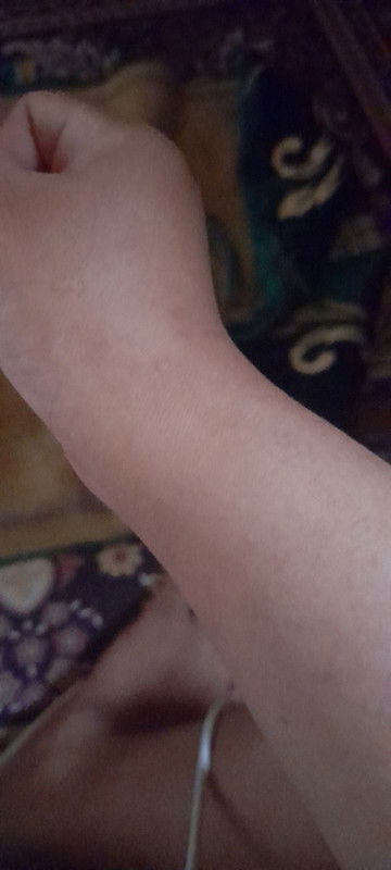 Pergelangan tangan sakit atau nyeri itu kenapa ya dok saat hamil kalo memegang gayung berisi air dll