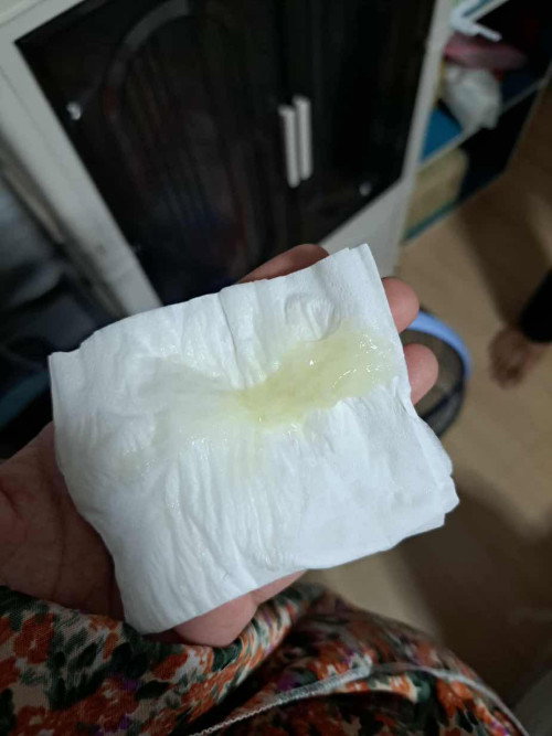 มีมูกแบบนี้ตอน37+3