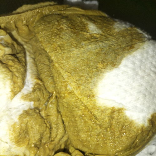 Poop bayi sufor 4 bulan