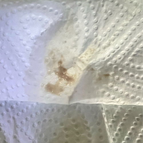 Nak tnye normal ke 10 week 4 day keputihan warna mcm nie.. risau lah keadaan kandungan kalau cmni..