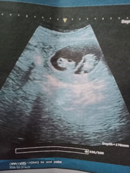 Disini ada grup hamil kembar gk ya?