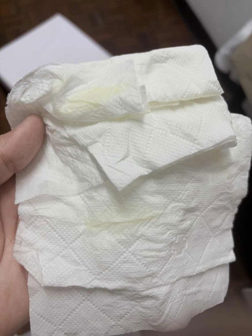 ท้อง 32+2wค่ะ แบบนี้คืออะไรคะแม่ๆ