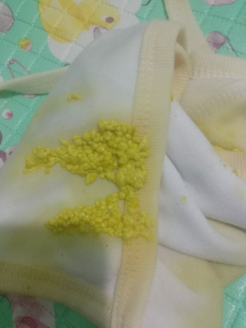 Baby ku 1 bulan,pup seperti ini sufor apa ini normal apa diare kadang pup nya disertai air