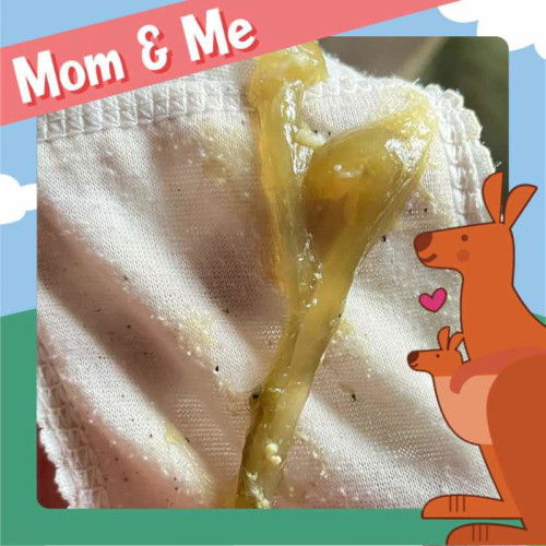 Usia 37 week, keluar lendir banyak.