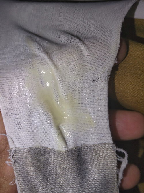 แบบนี้ควรไปหาหมอเลยมั้ยคะ