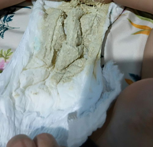 Pup bayi berwarna seperti ini