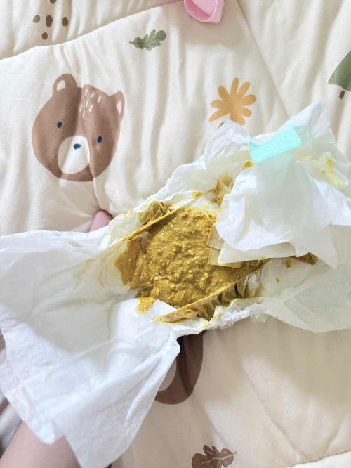 น้อง16วันอึแบบนี้ผิดปกติมั้ยคะ