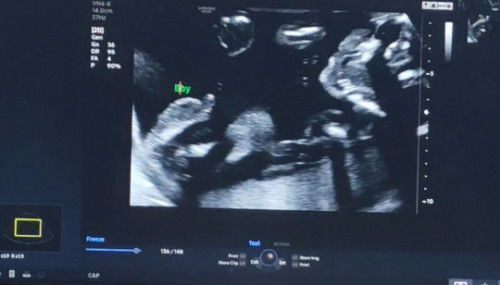 Jom share gender mommy2 yg lahir jun ni