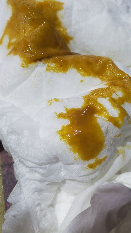 Bayi 4 bulan 15 hari