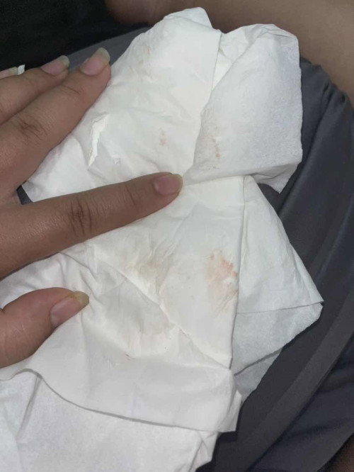 กำหนดคลอดมีนาคม